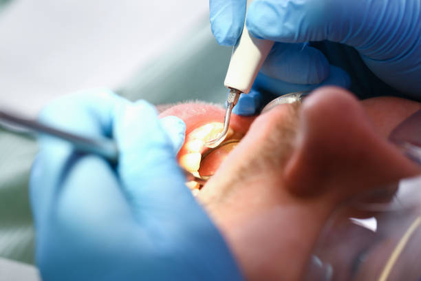 Best Pediatric Emergency Dentist in Saugatuck, CT