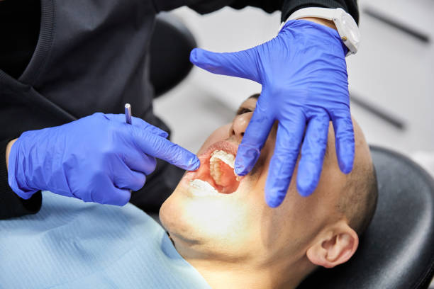 Best Emergency Tooth Extraction in Saugatuck, CT